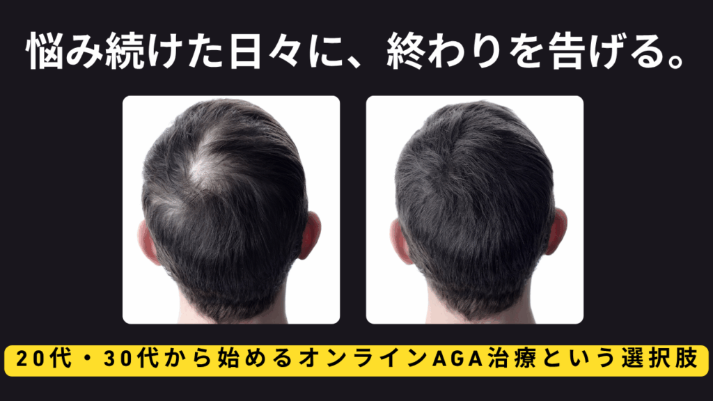 「抜け毛がやばい…」セルフケアで限界を感じたら。オンラインAGA治療という選択肢