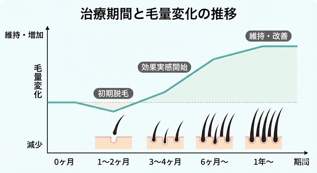 AGA治療を開始してからの期間と毛量変化の推移を示したグラフ。治療開始1〜2ヶ月頃に起こる一時的な「初期脱毛」による減少と、その後の3〜4ヶ月目以降の効果実感、6ヶ月目以降の維持・改善プロセスを視覚的に解説。