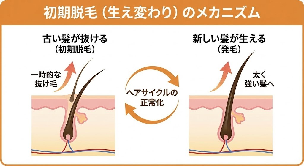 AGA治療における初期脱毛（生え変わり）のメカニズムを図解したイラスト。古い髪が抜け落ち、その後に新しく太い髪が生えてくるヘアサイクルの正常化プロセスを示す。